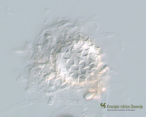 Značilne oospore s stožčastimi izrastki oomicete Globisporangium (Pythium) mastophorum z obolelih rastlin peteršilja.
