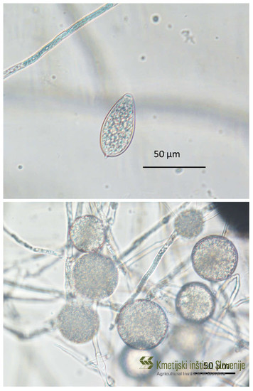 Sporangij (zgoraj) in klamidospore (spodaj) oomicetne plesni Phytophthora ramorum, ki povzroča fitoftorno sušico vejic